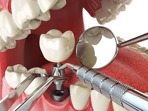 Best Emergency Treatment for Oral Infections in San Luis, AZ