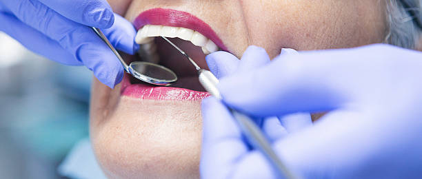 Best Emergency Wisdom Tooth Extraction in San Luis, AZ